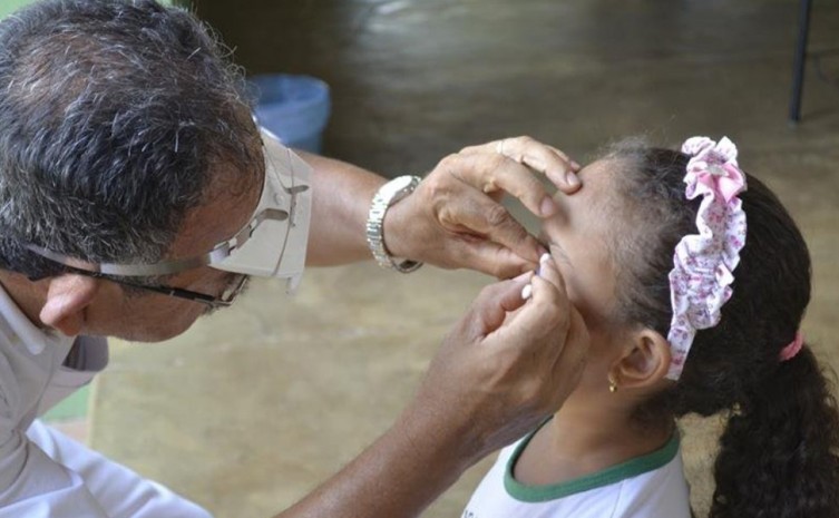 Saúde faz alerta sobre prevenção e tratamento do Tracoma em crianças