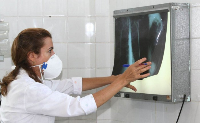 No Dia Mundial de Combate a Tuberculose, Saúde alerta para diagnóstico e tratamento da doença