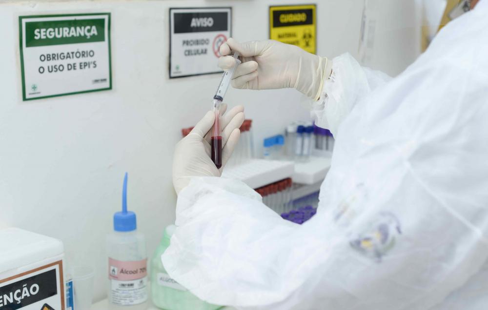 Saúde de Palmas contrata técnicos em laboratório e análises clínicas