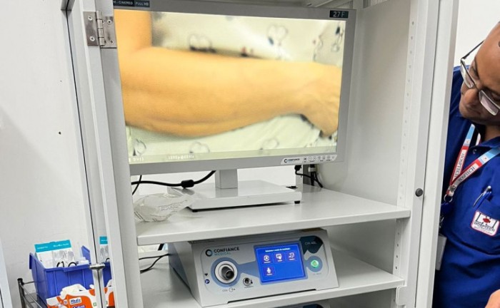 Governo do Tocantins entrega sistema de videolaparoscopia aos hospitais estaduais 